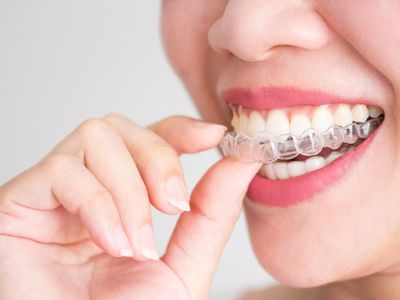 invisalign